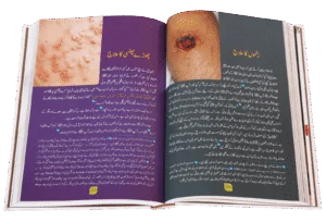 Tib-e-Nabvi. Urdu